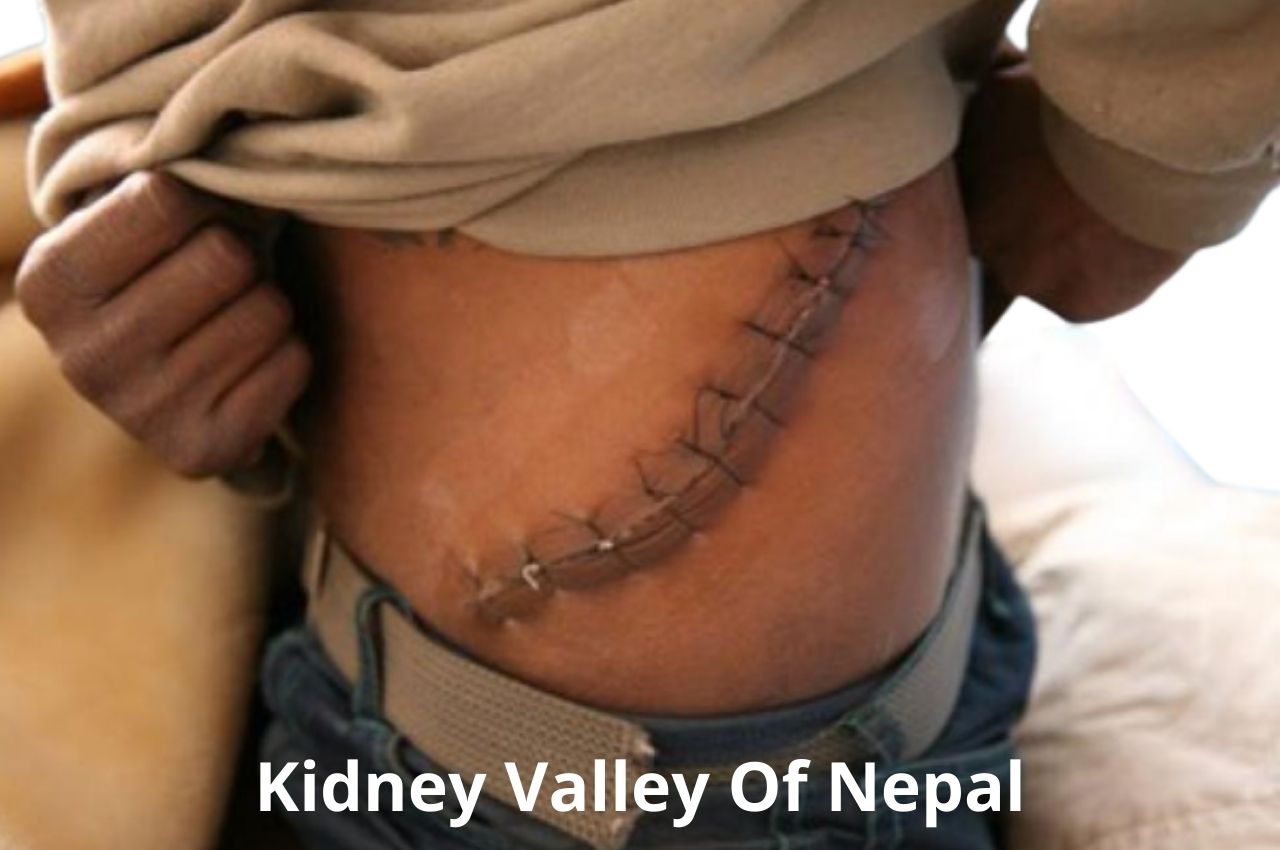 The Kidney Valley Of Nepal